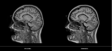 MRI装置用画質改善ソフトウェア・モジュール GOPView MRI2Plus digital X-Ray gopview MRI