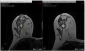 Myrian 用CT, MRI, CT/MRI オプション Onco