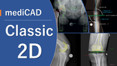 整形外科2Dデジタルプランニングツール 『mediCAD Classic』