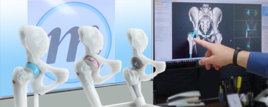 整形外科3Dデジタルプランニングツール 『mediCAD Hip 3D』 Hip3D