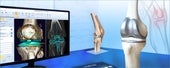 整形外科3Dデジタルプランニングツール 『mediCAD Knee 3D』