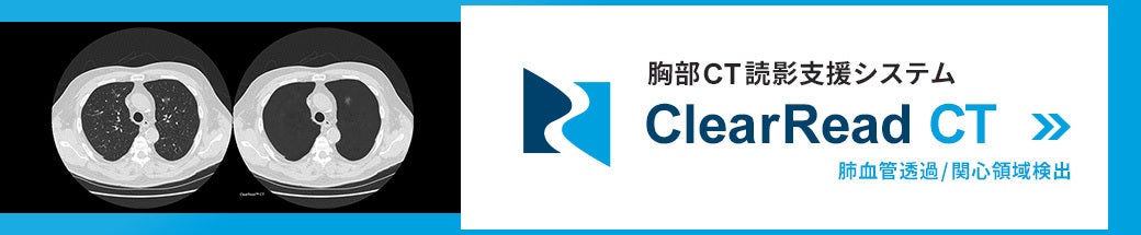 胸部CT読影支援システム ClearRead CT