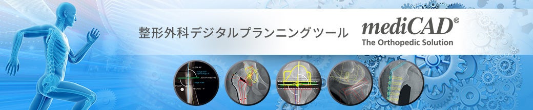 整形外科デジタルプランニングツール mediCAD