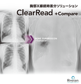 胸部X線経時差分処理システム 『ClearRead +Compare』