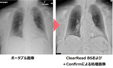 X線画像 MITテクノロジーレビュー