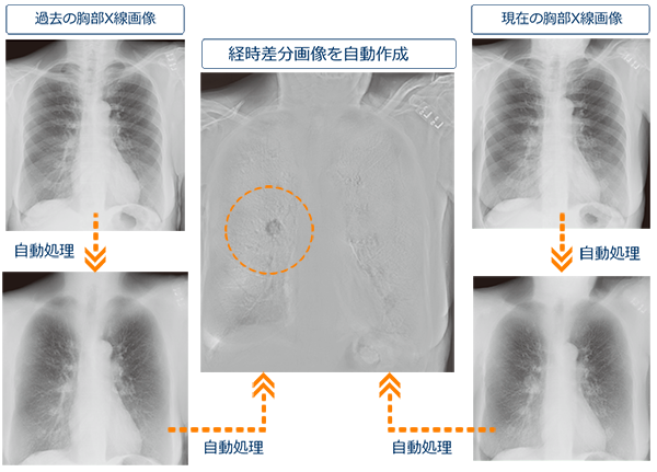 経時差分画像