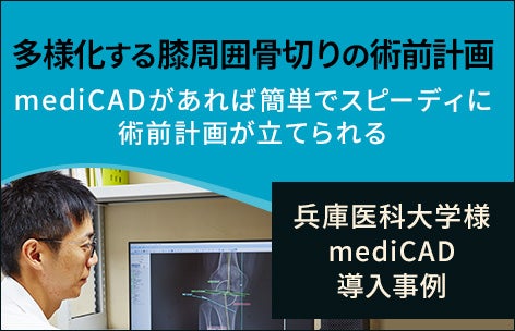 mediCAD兵庫医科大学様事例