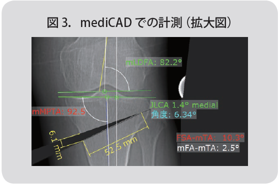 Figure3