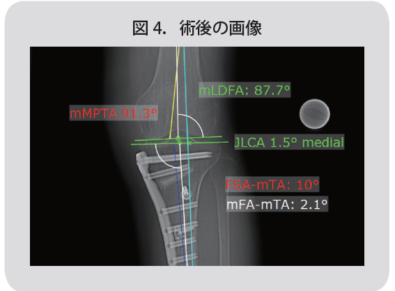 Figure4