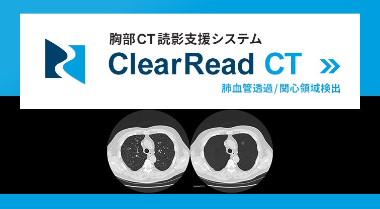 胸部CT読影支援システム　ClearRead CT