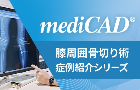 mediCAD_AKO症例紹介シリーズ