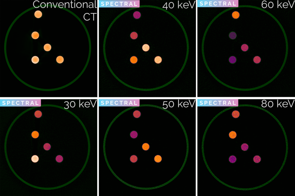 Spectral CT技術